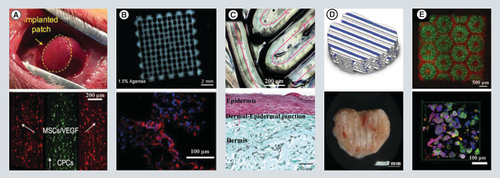 Figure 5. Heart, neural network, skin, bone, and liver fabricated by 3D bioprinting. (A) Optical image of bioprinted prevascularized cardiac patch after implantation. The two type of stem cells were alternatively patterned in a 3D grid structure. (B) A neural scaffold consisted of 5% w/v alginate, 5% w/v carboxymethylchitosan and 1.5%agarose. The TUJ1 signal of bioprinted cells (21-day differentiation) implied persistent cell viability, with neuronal cell clusters interconnected by neurites (blue: nucleus; red: TUJ1). (C) A hybrid bioink containing gelatin, alginate and fibrinogen was used to fabricate skin constructs. The top image showed 200 μm wide lines printed by this bioink. Pink arrows indicated motion paths of the printing nozzle. Masson's Trichrome staining of bioprinted skin constructs, which recapitulated three typical layers of normal human skin. (D) An image of a composite vertebrae model that was bioprinted by alternative deposition of PCL filaments (white) and cell-populated bioink (blue). Macroscopic image of anatomically shaped vertebrae constructs after 12 weeks of implantation. (E) An immunofluorescence image showing hiPSC-HPC (green) and supporting cells (red) arranged in a hexagona hepatic model. The hiPSC-HPC aggregates positively expressed albumin (red) and E-cadherin (green) on day 7 postprinting, demonstrating active proliferation and metabolic function (blue: nucleus). (A) Reproduced with permission from [Citation121] © Elsevier Ltd. (2017). (B) Reproduced with permission from [Citation122] © John Wiley and Sons Inc. (2016). (C) Reproduced with permission from [Citation123] © John Wiley and Sons Inc. (2017). (D) Reproduced with permission from [Citation124] © John Wiley and Sons Inc. (2016). (E) Reproduced with permission from [Citation125] © PNAS (2016).CPC: Cardiac progenitor cell; hiPSC: Human induced pluripotent stem cells; HPC: Hepatic progenitor cell; MSC: Mesenchymal stem cell; PCL: Poly(ε-caprolactone).