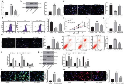 Figure 1. ML264 treatment reduces H/R-induced damage in H9C2 cells. A KLF5-specific inhibitor ML264 was introduced in H/R-treated H9C2 cells at 10 μmol/mL. A-B, mRNA (a) and protein (b) expression of KLF5 in cells determined by RT-qPCR and western blot analysis, respectively (one-way ANOVA, ** p < 0.01 vs. Control, ## p < 0.01 vs. H/R treatment); C-D, viability of cells determined by EdU labeling (c) and CFSE labeling (d) (one-way ANOVA, ** p < 0.01 vs. Control, ## p < 0.01 vs. H/R treatment); E, proliferation of cells determined by CCK-8 method (two-way ANOVA, ** p < 0.01 vs. Control, # p < 0.05, ## p < 0.01 vs. H/R treatment); F, LDH production in cells determined using an LDH kit (one-way ANOVA, ** p < 0.01 vs. Control, ## p < 0.01 vs. H/R treatment); G, Caspase-3 activity in H9C2 cells measured using a Caspase-3 detection kit (one-way ANOVA, ** p < 0.01 vs. Control, ## p < 0.01 vs. H/R treatment); H-I, apoptosis of H9C2 cells determined by Hoechst 33342/PI double staining (h) and flow cytometry (i) (one-way ANOVA, ** p < 0.01 vs. Control, ## p < 0.01 vs. H/R treatment); J-K, mRNA (j) and protein (k) expression of apoptosis-related factors Bax, Bcl-2 and Apaf1 in cells determined by RT-qPCR and western blot analysis, respectively (two-way ANOVA, ** p < 0.01 vs. Control, ## p < 0.01 vs. H/R treatment); L-M, ROS concentration in cells examined using CellROX Green (l) and MitoSox Red (m) kits (one-way ANOVA, ** p < 0.01 vs. Control, ## p < 0.01 vs. H/R treatment). Data were exhibited as mean ± SD from at least three independent experiments