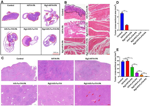 Figure 5. Histopathological analyses of the antitumor efficacy of Rg3-H/5-Fu-F/H-PA. (A) H&E staining of the intestine and tumor tissues. Red circles indicated the tumor tissues. (B) H&E staining of the diaphragm. Black circles indicated the invaded tumor tissues. Scale bar = 100 μm. (C) H&E staining of liver tissues. Scale bar = 200 μm. (D) Cross-sectional tumor area in the diaphragm. (E) Cross-sectional tumor area in liver. For control and H/F/H-PA groups in D, n = 3. For each group in E, n = 6.