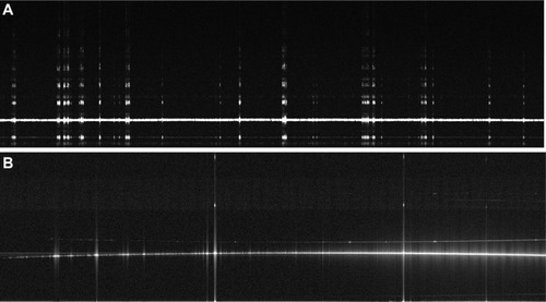 Figure 3 An 18.25 mm lateral scan across a flat surface.