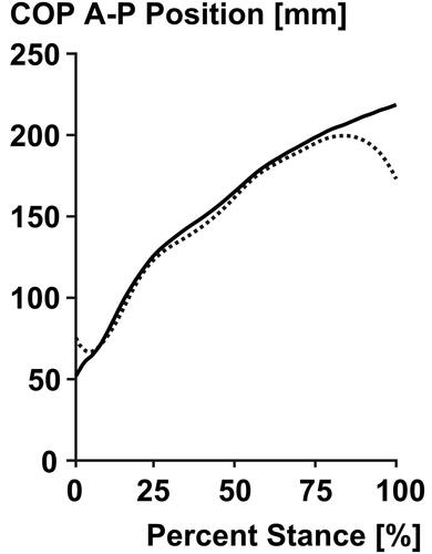 Figure 2. Mean (n = 8 steps) centre of pressure (COP) a–p position for one subject running in the Nike Vaporfly 4% shoe on the treadmill (solid line) and overground (dashed line) at a constant speed of 3.8 m/s.