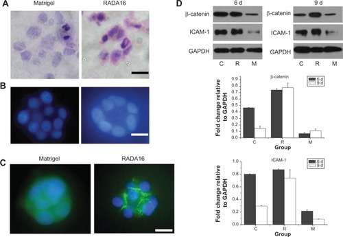 Figure 4 Cellular characteristics and the localization and expression of signaling proteins in RADA16 cells colonies.Notes: (A) Hematoxylin staining of cryostat sections of the Matrigel and RADA16 scaffolds show lumen formation only in RADA16 scaffold. Scale bar represents 25 μm. (B) The nuclei of cell colonies stained with DAPI show lumen formation in RADA16 and irregular organization in Matrigel. Scale bar represents 25 μm. (C) Immunolocalization of β-catenin (green) with DAPI stained nuclei (blue) in RADA16 and Matrigel scaffolds. The β-catenin is diffusely localized in the cytoplasm, nucleus, and some cell–cell contacts within colonies formed in Matrigel but forms intense localization in the cell–cell junctions in colonies formed in RADA16, indicating similar β-catenin distribution like that of nonmalignant S-1 cells.Citation32 Scale bar represents 25 μm. (D) Western blot analysis of the indicated proteins β-catenin and ICAM-1 of MDA-MB-435S cells in different three-dimensional cultures at 6 days and 9 days. Equal amounts of protein were loaded per lane, and GAPDH was run as a control for equal loading and exposure time. Matrigel® (BD Biosciences, Two Oak Park, Bedford, MA, USA).Abbreviations: 6 d, 6-day cultures; 9 d, 9-day cultures; C, collagen; DAPI, 4′,6-diamidino-2-phenylindole, dihydrochloride; GAPDH, glyceraldehyde-3-phosphate dehydrogenase; ICAM-1, intercellular surface adhesion molecule-1; M, Matrigel; R, RADA16; RADA16, COCH3-RADARADARADARADA-CONH2.