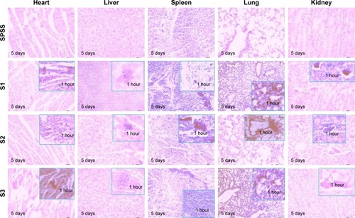 Figure 6 Pathological changes of the heart, liver, spleen, lungs, and kidney after tail vein injection with different sized IONPs (200× on the 5th day, HE staining). S1, S2, and S3 were 14 nm IONP@PEG2,000, 14 nm IONP@PEG5,000 and 22 nm IONP@PEG5,000, respectively.