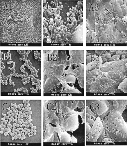 FIG. 3.  SEM morphology of various nanoparticles prepared by different organic solvents (with different mixing ratio of DMSO and CH2Cl2). (A) Organic phase is DMSO, degradation Time T = 0d (A1), T = 3 d (A2), and T = 5 d (A3). (B) Organic phase is DMSO + CH2Cl2, degradation Time T = 0d (B1), T = 3d (B2), and T = 5d (B3). (C) Organic phase is CH2Cl2 only, degradation Time T = 0d (C1), T = 3d(C2), and T = 5d (C3).