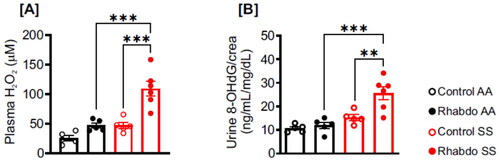 Figure 4. Rhabdo induces oxidative stress in SS mice. (A) Plasma H2O2 and (B) urinary 8-OHdG in control and rhabdo AA and SS mice (one-way ANOVA, with Holm-Šídák’s posthoc test).