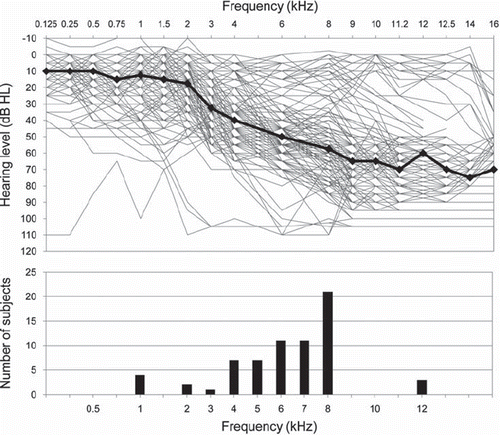 Figure 1. Association between hearing level and the dominant tinnitus pitch. Top panel illustrates audiometric thresholds for all 67 patients (134 ears) with the median data shown by the black line. Bottom panel shows the distribution of the dominant tinnitus pitch derived from the similarity ratings.