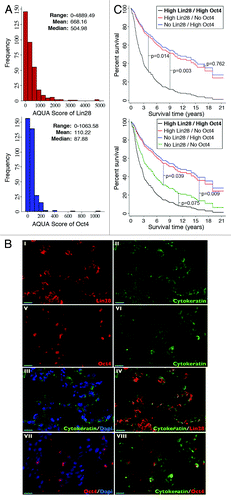 Figure 3. (A) Distributions of AQUA scores for Lin28 (top) and Oct4 (bottom) expressions in the Yale Ovarian Cancer Cohort. The range, mean and median values are indicated. (B) Examples of immunofluorescence of human epithelial ovarian cancer samples using antibodies specific for Lin28 (I, in red), Oct4 (V, in red) or cytokeratin (II and VI, in green), respectively. The Dapi stain (III and VII, in blue) indicates cell nuclear compartment. III, merge of cytokeratin and Dapi; VII, merge of Oct4 and Dapi; IV, merge of cytokeratin and Lin28; VIII, merge of cytokeratin and Oct4. Bar = 20 μm. (C) Survival curves from a Cox proportional hazards regression analysis that included as covariates Lin28 and Oct4, along with their interaction term. Assessment of Lin28 and Oct4 expressions was performed in 3-fold redundancy.