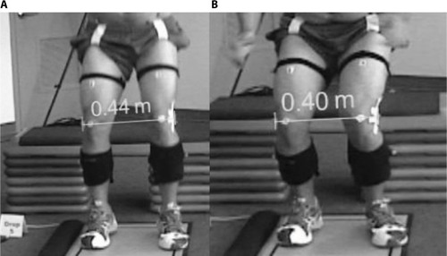 Figure 3 KSD quantified as the distance (in meters) between the right and left lateral femoral epicondyle markers between initial contact phase (A) and peak knee flexion (B).
