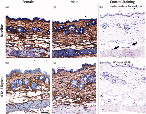 Figure 5. Qualitative analysis of histology in control and treated mice. (A–D) HABP stained representative 40× images of dorsal skin of baseline (top row) vs. topical 4-MU treated (bottom row) in female (left column) and male (right column) mice are shown. (A–B) Female mice have thicker epidermal layer and more adiposity at baseline, while male mice have a thicker dermal layer and less adiposity. (A–D) Treatment with topical 4-MU resulted in dermal matrix disorganization in both male and female mice compared to baseline. (E–F) Control staining of dorsal skin. (E) HABP staining following treatment with hyaluronidase. Arrows indicate areas of residual HA following hyaluronidase digestion. (F) Secondary antibody only staining without HABP.