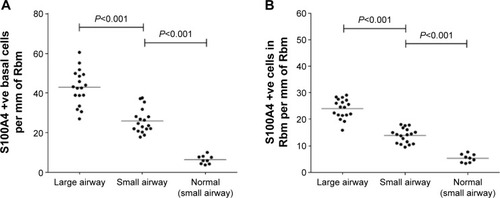 Figure 5 (A) Comparison of S100A4 expression in the (basal) epithelial cells of large airway in CAL patients, with small airway of CAL patients and normal control small airway. (B) Comparison of S100A4 expression in Rbm of large airway in CAL patients with small airway of CAL patients and normal control small airway.Abbreviations: CAL, chronic airflow limitation; Rbm, reticular basement membrane.