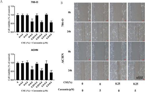 Figure 6 Curcumin reduces the EMT induced by CSE through suppressing ERK5/AP-1. (A) An MTT assay was conducted to screen a suitable concentration for subsequent experiments. Treatment with CSE at various doses under 6 µM curcumin revealed lower cell viability below 70%, which proved to be toxic to ACHN and A498 cells. (B) A wound-healing assay showing that CSE-enhanced migration was weakened by curcumin. Data are expressed in the manner of mean ± SD. **P<0.01 relative to control group.