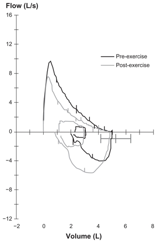 Figure 1 Spirometry results: pre-exercise challenge and post-exercise challenge.