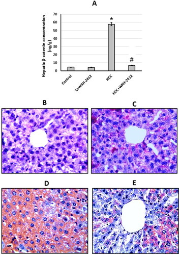 Figure 7. Effect of 5 mg/kg WRH-2412 on β-catenin protein levels (A) as well as liver sections stained with anti- β-catenin antibody in control group (B), control group treated with WRH-2412 (C), HCC group (D) and HCC group treated with WRH-2412 (E). *p < 0.05 vs. control; #p ≤ 0.05 vs. HCC group; HCC: hepatocellular carcinoma; C: control.