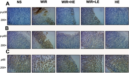 Figure 8 Representative pictures showing the immunohistochemical analysis of p-p38, p-p65 and NF-κB p65 in sections of gastric mucosa obtained from rats.