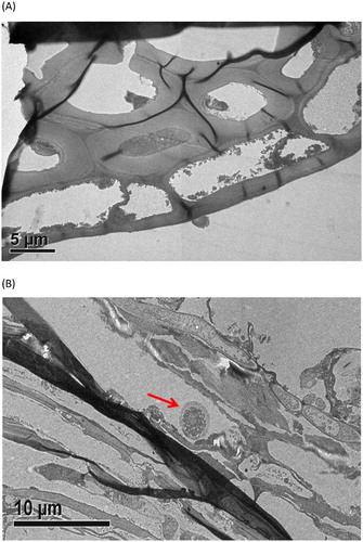 Figure 2. Transmission electron microscope of rice straw (A) and rice straw fermented by Trichoderma (B), the red arrow indicated the invasion of Trichoderma hypha.
