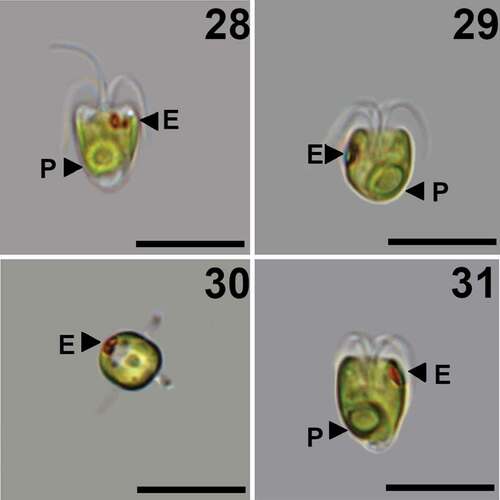 Figs 28–31. Pyramimonas octopora sp. nov., LM. Scale bars = 10 µm.