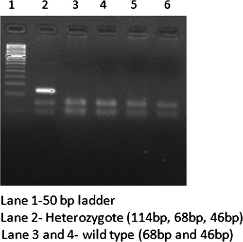 Figure 2. Gel picture of FLT3-D835 mutants.