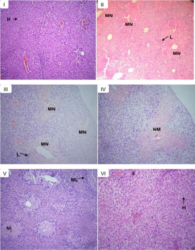 Figure 3 Histopathological section of liver tissues in control and experimental groups of mice in the pre-treatment model; showing normal hepatic cells (H), lymphocytic inﬁltrates (L), multifocal necrosis (MN), moderate necrosis (NM), mild lymphocytic inﬁltrates (ML), and mild necrosis (NL). (A) Normal control received with distilled water, (B) toxic control received CCl4, (C) treated with 125 mg/kg extract, (D) treated with 250 mg/kg extract, (E) treated with 500 mg/kg extract, and (F) treated with silymarin 100 mg/kg.