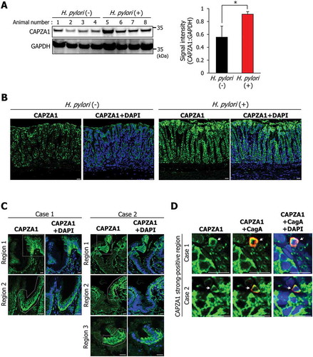 Figure 7. CAPZA1-overexpressing cells in H. pylori-infected gastric mucosa and early gastric cancer tissues. (a) Mongolian gerbils were inoculated with H. pylori (109 CFU/mL) or vehicle. Twelve weeks after the inoculation, the animals were sacrificed, and their stomachs were excised. Western blotting using protein extracts for detection of CAPZA1 was performed. CAPZA1 signal intensity of each mouse were analyzed using the ImageJ program. *P < 0.05. (b) Staining of the stomach tissue for CAPZA1 was performed. Scale bar: 20 μm. (c) Immunostaining for CAPZA1 in human gastric adenocarcinoma. Case 1 and case 2 indicate individual gastric adenocarcinoma tissue specimens from 2 different patients. Green color indicates CAPZA1 staining. Nuclei (blue color) were stained with DAPI. The region surrounded by the white dotted line indicates a CAPZA1 strongly stained cell area. Scale bar: 20 μm. (d) Immunostaining for CagA and CAPZA1 in human gastric adenocarcinoma. Red staining indicates intracellular CagA, and green staining indicates CAPZA1. Nuclei (blue) were stained with DAPI. Scale bar: 20 μm. Arrows indicate accumulation of translocated CagA in the gastric epithelial cells strongly stained for CAPZA1.