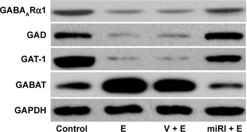 Figure 4 miR-210 inhibitor prohibited epilepsy-induced changes of GABA-related protein expressions.