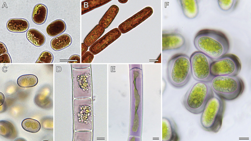 Figure 6. Non-photosynthetic pigments of Mesotaenium-like algae and other zygnematophytes. (a) Ancylonema alaskanum with dark-red vacuolar contents (Morteratsch Glacier, Switzerland; courtesy of D. Remias). (b) Ancylonema nordenskioeldii with red cellular contents (Morteratsch Glacier, Switzerland; micrograph from Procházková et al., Citation2021). (c) Cells of lineage Meso-7 with rose cellular contents (Wet walls, Great Smoky Mountains, North Carolina, USA). (d) Zygogonium ericetorum with pink vacuolar contents (Streamlet, Schoenwieskopf, Tyrol, Austria; micrograph from Aigner et al., Citation2013). (e) Temnogametum iztacalense with purple vacuolar contents (Lake La Luna, Nevado de Toluca, Mexico; courtesy of G. Garduño Solorzano). (f) Serritaenia sp. with purple-blue pigment in extracellular mucilage (from moss shown in Fig 5(f,g)). Scale bars 10 µm, scale information for (c) not available.