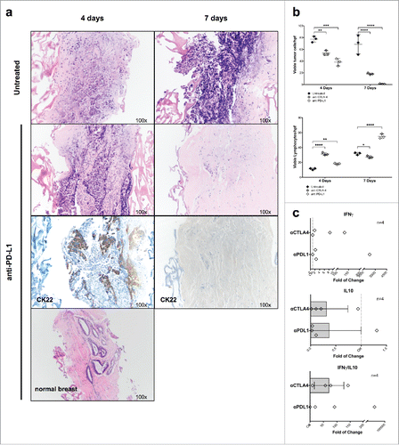 Figure 5. Culture of breast cancers in the presence of therapeutic mAb recognizing immunological checkpoints. (A) Fragments from a representative, untreated TNB cancer were cultured for the indicated time points in perfused bioreactors in the presence or absence of anti-PD-L1 therapeutic mAb (10 μg/mL). Samples were then fixed and paraffin embedded. Sections were stained with HE- and anti CK22-specific reagents (Magnification 100×). (B) Fragments from three different untreated TNB cancers were cultured in perfused bioreactors in the presence or absence of anti PD-L1 or anti CTLA-4 therapeutic mAbs (10 μg/mL) for the indicated time points. Numbers of vtc and lymphocytes in cultured tissue were then comparatively evaluated. Two-way ANOVA, matched values with Dunnett's multiple comparison test (*p ≤ 0.05; **p ≤ 0.01; ***p ≤ 0.001; ****p ≤ 0.0001). (C) Triplicate fragments of a luminal A breast cancer were treated for 7 d in perfused bioreactors, in the presence of the indicated therapeutic mAbs. Total cellular RNA was then extracted and reverse transcribed. The expression of the indicated genes was evaluated by qRT-PCR. Data are reported as fold increases or decreases, as compared with the expression of the same genes in untreated samples. IFNγ/IL-10 gene expression ratios are also shown.