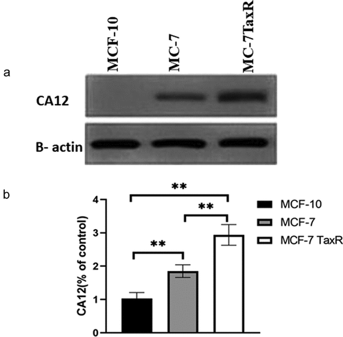 Figure 1. Expression of CA12 protein in different breast cell lines (x ± s, n = 3) by western blot.(a) The expression of CA12 protein in different breast cell lines; (b) The relative expression of CA12 protein in different breast cell lines; **: Comparison between groups, P < 0.01