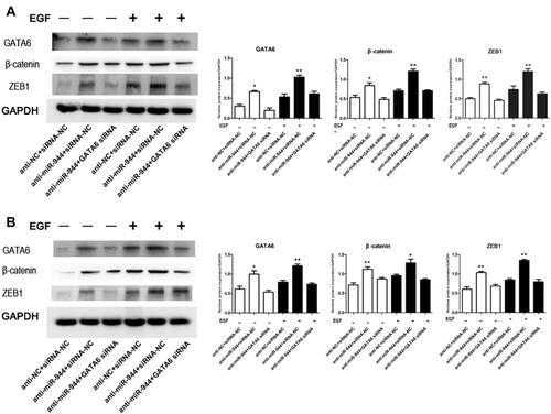 Figure 6 GATA6, β-catenin, and ZEB1 protein changes in rescue experiment. Knockdown reversed the increased GATA6, β-catenin, and ZEB1 expression levels induced by the miR‐944 inhibitor with or without EGF (50 ng/mL) treatment. (A) GATA6 antisense experiments in Human colon cancer cells‐116 (HCT116) cells, and (B) GATA6 antisense experiments in SW480 cells, n = 3, *P < 0.05 and **P < 0.01 using t-test.