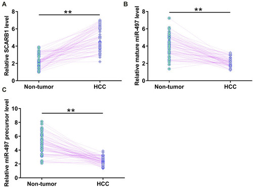 Figure 1 The expression of circRNA SCARB1, mature miR-497 and miR-497 precursor was altered in HCC. HCC and paired non-tumor tissues were collected from the 64 HCC patients included in this study, and the expression of circRNA SCARB1 (A), mature miR-497 (B) and miR-497 precursor (C) in these tissue samples was determined by RT-qPCR. Average values of three technical replicates were used to express gene expression data in paired HCC and non-tumor tissues, **p < 0.01.