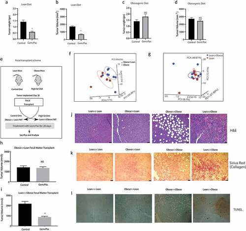 Figure 2. High fat diet fed mice show resistance to chemotherapy: KPC001 cells were implanted subcutaneously in C57BL6 mice on control and high fat diet and treated with Gem/Pac for 4 weeks. Tumor weight (a) and tumor volume (b) in mice on control (lean) diet showed significant decrease. Tumor weight (c) and tumor volume (d) in mice on high fat (obesogenic) diet showed no significant response. Schema for fecal transplant (e) is shown in which the high fat diet fed mice received the lean mice microbiome and vice versa. PCoA plots of Obese to lean transplant (f) and lean to obese transplant (g). Obese≫Lean FMT showed loss of response in the presence of chemotherapy (h) while Lean≫Obese FMT showed sensitivity to chemotherapy (i). Visible changes in histology was observed in the Lean≫Obese FMT in H&E slides (j), collagen deposition (k) and TUNEL staining (l).