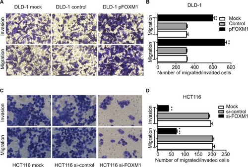 Figure 4 Impact of altered FOXM1 expression on colon cancer cell migration and invasion in vitro. DLD-1 and HCT116 cells were transfected with pFOXM1 and si-FOXM1, respectively.Notes: (A) DLD-1 and (C) HCT116 cells migration and invasion were detected by the Transwell assays and were determined as described in Materials and Methods. Representative migrated or invaded colon cancer cells were photographed. (B and D) Statistical graphs show the relative number of migrated and invaded cells. Upregulated FOXM1 expression significantly promoted migration and invasion of DLD-1 cells. However, downregulated FOXM1 expression markedly suppressed the migration and invasion capacity of HCT116 cells. Data are shown as the mean ± SD. **P<0.01, ***P<0.001, compared with controls. Scale bar 200μm.Abbreviations: pFOXM1, pcDNA3.1-FOXM1; si-control, control-siRNA; si-FOXM1, FOXM1 siRNA.