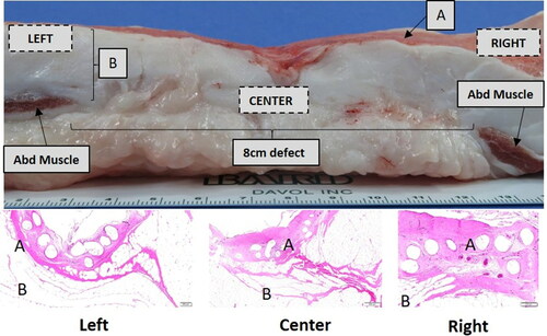 Figure 8. Hematoxylin & Eosin (H&E) stained slides obtained to the left, center, and right of the 8 cm unclosed defect site (72 weeks postimplantation). The left, center, and right locations denoted in the top panel indicate the approximate location of the slides displayed in the bottom panel; A = Mesh/Peritoneal Surface, B = Preperitoneal Fat and Abd Muscle = Abdominal Muscle. Comparable mature collagen/fibrovascular tissue was observed around and within the Phasix™ ST Mesh interstices, including the segment of mesh overlying the defect.