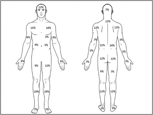 Figure 2. Proportions of participants with pain in selected regions at commencement of PR.