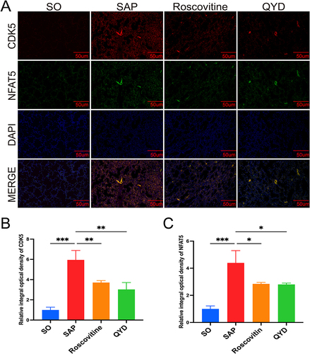 Figure 7 Lung tissue immunofluorescence in rats. (A) Immunofluorescence analysis of CDK5 (red), NFAT5 (green), and nucleus (blue) expression in lung tissue (scale bar=50μm). (B and C) Semi-quantitative analysis of CDK5 and NFAT5 expression; *P < 0.05, **P < 0.01, ***P < 0.001.