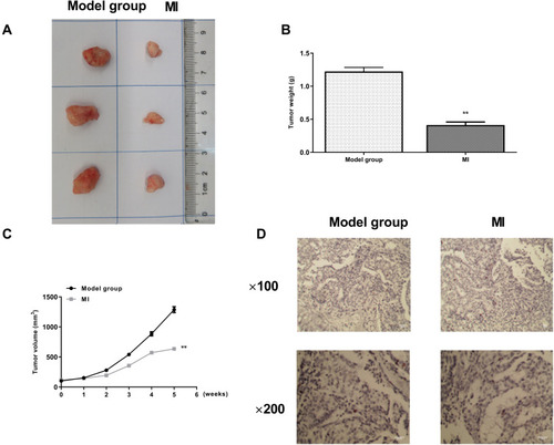 Figure 5 MI inhibits tumor growth of laryngeal cancer in vivo. (A–D) The effect of MI on tumor growth of laryngeal cancer in vivo was analyzed by tumorigenicity assay in nude mice. The HEP-2 cells were treated with MI (300 mg/kg) or equal volume saline and injected into the nude mice (n = 3). (A) Representative images of dissected tumors from nude mice were presented. (B) The average tumor weight was calculated and shown. (C) The average tumor volume was calculated and shown. (D) The expression levels of Ki-67 of the tumor tissues were measured by immunohistochemical staining. Data are presented as mean ± SD. Statistic significant differences were indicated: ** P < 0.01.