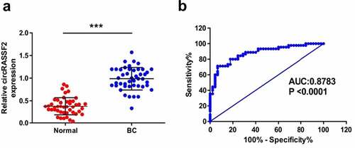 Figure 2. CircRASSF2 is highly expressed in serum of patients with BC and can be a good diagnosis marker. (a) The expression levels of circRASSF2 in BC serum were detected by qRT-PCR. (b) ROC analysis was used for calculating predictive values. *, P < 0.05; **, < 0.01; ***, P < 0.001