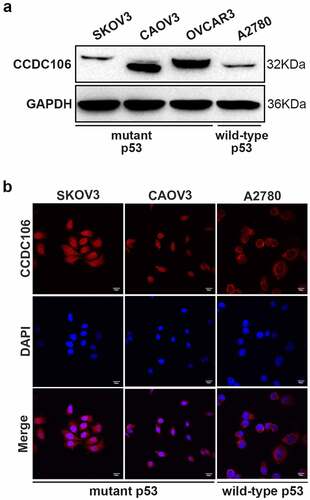 Figure 1. Protein expression levels and subcellular distribution of CCDC106 in ovarian cancer cells. (a, b) Expression levels and localization of CCDC106 in mutant p53 (SKOV3, CAOV3, OVCAR3) and in wild-type p53 (A2780) ovarian cancer cell lines assessed by Western blot and immunohistochemistry, respectively. Scale bars = 100 μm. All experiments were repeated three times with similar results.