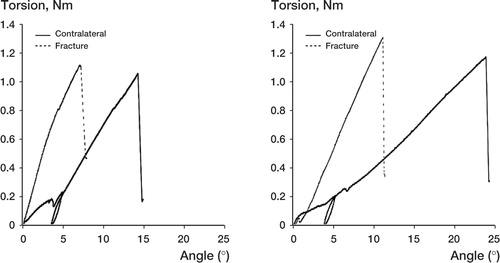 Figure 4. Computerized torque-angle displacement graphs of (left) 0-mm fracture defects, and (right) 2-mm fracture defects, and corresponding contralateral leg after 12 weeks of healing.