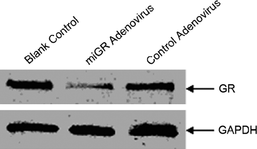 Figure 5.  Knockdown in vitro of GR expression by adenovirus-mediated RNA interference. Cultured Leydig cells were infected with miGR adenovirus (expressing miRNAs targeting the rat GR gene) or control adenovirus for 72 h (MOI = 100). Intact Leydig cells served as the blank control. Total protein samples (20 μg) were electrophoresed in 8% polyacrylamide gel and transferred to a nitrocellulose membrane. The protein of interest was detected by antibody against GR, and the luminescent signal was detected by exposing the membrane to an X-ray film. GAPDH was used as the internal control for normalisation.