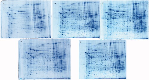 Figure 2. Differential effect of AS treatment on BD as visualized by 2D PAGE. Liver were extracted and analyzed by 2D PAGE (first dimension, 18 cm, pH 4–7, nonlinear gradient of IPG strips; second dimension, 12.5% SDS-PAGE) and visualized by silver staining. (A) control; B BD; C ASM; D ASL;E ASH;.