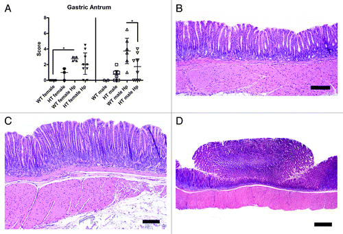 Figure 5. (A) Total histopathology index score of the antrum in the different groups of mice (*, p < 0.05). (B) Relatively normal gastric antrum of a hepatitis C virus transgenic male mouse infected with H. pylori (HT male Hp). (C) Mucosal hyperplasia with mild dysplasia in the gastric antrum of a wild-type male mouse infected with H. pylori (WT male Hp). (D) Polypoid lesion in the gastric antrum of a wild-type male mouse infected with H. pylori (WT male Hp). (B and C) bar size 100 µm. (D) bar size 500 µm.
