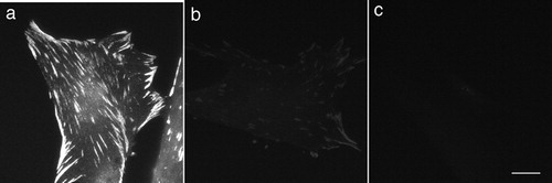 Figure 3. Conventional imunofluorescent microscopy stained with anti-vinculin and control experiments. Human foreskin fibroblasts were conventionally fixed and stained with anti-vinculin without microwave irradiation (a). Immunofluorescent intensity was almost the same as that of rapid staining with microwave irradiation. When fixed cells were incubated with anti-vinculin without microwave irradiation (first antibody for 5 minutes and then secondary antibody for 5 minutes), only faint immunofluorescent staining was exhibited (b). Fixed cells incubated only with fluorescent-labeled secondary antibody, without first antibody, did not show any immunofluorescent signaling (c). Bar = 20 μm.