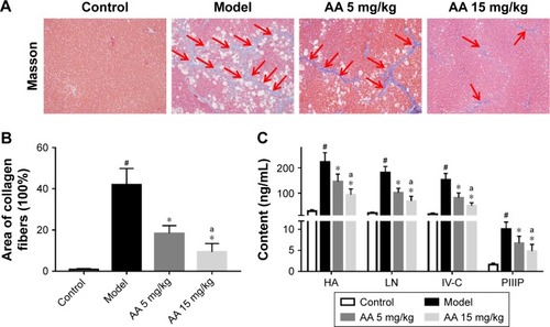 Figure 2 AA ameliorates CCl4-induced liver fibrosis in rats.