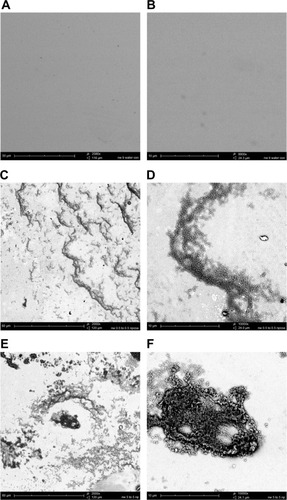 Figure 3 CHX-HMP nanoparticles on titanium: (A and B) control (no nanoparticles); (C and D) CHX-HMP-0.5 nanoparticles; and (E and F) CHX-HMP-5 nanoparticles.Notes: The untreated titanium appeared featureless at this resolution. The CHX-HMP-0.5 surface was coated with small deposits of the nanoparticles. The CHX-HMP-5 surface displayed larger aggregates of the nanoparticles across much of the surface. A, C, and E were taken at original magnification 2000x; the scale bar is 50/60 μm. B, D, and F were taken at original magnification 1000x; scale bar is 10 μm.Abbreviations: CHX-HMP, chlorhexidine hexametaphosphate; CHX-HMP-0.5, chlorhexidine hexametaphosphate (0.5 mmol L−1); CHX-HMP-5, chlorhexidine hexametaphosphate (5 mmol L−1).