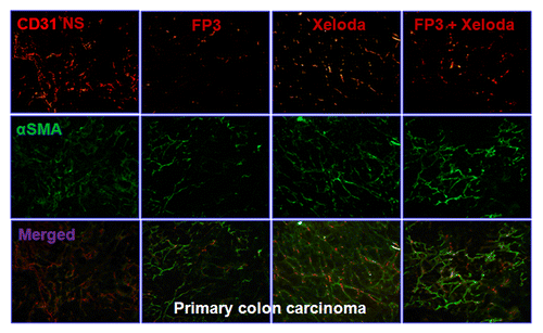 Figure 3. FP3 and capecitabine (Xeloda) decreased vascular structure in the xenograft model of primary colon carcinoma. Vasculature was examined by angiography with immunostaining for endothelial cells (using anti-CD31 antibody; bar = 100 μm), and pericytes (using anti-α-SMA antibody; bar = 100 μm). Figure 4. FP3 and capecitabine (Xeloda) decreased vascular structure in the xenograft model of colon carcinoma lymphatic metastasis. Vasculature was examined by angiography with immunostaining for endothelial cells (using anti-CD31 antibody; bar = 100 μm), and pericytes (using anti-α-SMA antibody; bar = 100 μm).