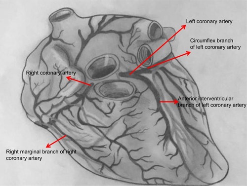 Figure 1 Gross anatomy of heart.