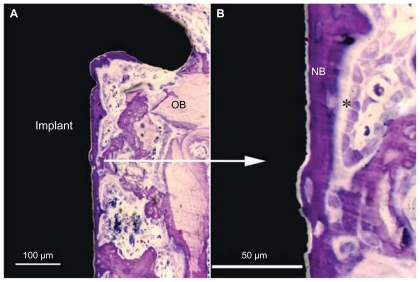 Figure 7 Histological non-decalcified ground sections of bone interface in the 60 nm group after seven days of implantation. (A) Low magnification image showing newly formed bone growing directly and along the implant surface in the endosteal compartment but also extending from the old bone onto the implant surface. (B) Higher magnification of the image (A) showing active bone formation directly on the implant surface (contact osteogenesis).Note: *Indicates steoblast-like cell.Abbreviations: OB, old bone; NB, new bone.