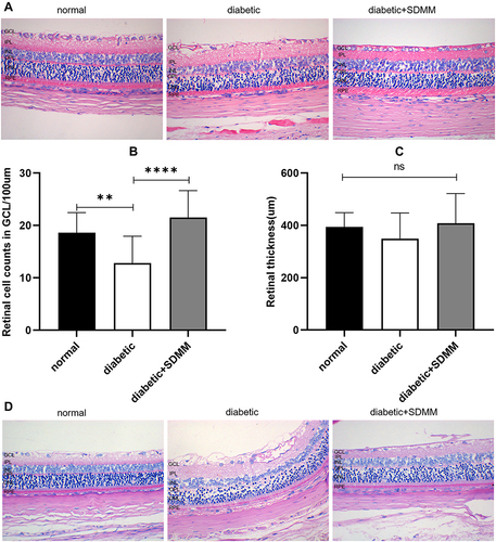 Figure 1 Effects of Shuangdan Mingmu (SDMM)capsules on retinal structure in STZ-induced diabetic rats. (A) retinal HE-stained images; (B) retinal cell counts in GCL; (C) retinal thickness from RPE to GCL; (D) Images of retinal PAS staining. χ±s, n=3, **p<0.01, ****p<0.0001, scale bar 100um.
