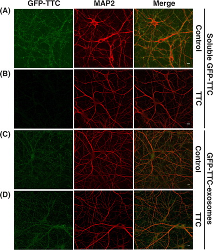Fig. 6.  GFP–TTC exosomes do not bind to the neuronal surface because of their TTC cargo. (A, B) Incubation with TTC abolishes GFP–TTC staining of neurons: GFP–TTC was diluted to 0.36 nM in culture medium and incubated for 1 h on 16 DIV hippocampal neurons in absence (A) or in presence (B) of 100 nM TTC. In B) cells were pre-incubated for 20 min with 100 nM TTC. (C, D) TTC does not impair binding of GFP–TTC-exosomes to neurons: GFP–TTC-exosomes were incubated for 1 h on 16 DIV hippocampal neurons in absence (C) or in presence (D) of 100 nM TTC. In D) cells were pre-incubated for 20 min with 100 nM TTC. After incubation, cells were washed, fixed and immunolabelled with anti-MAP2 (red) (A, B, C and D). Scale bars: 10 µm.