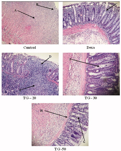 Figure 1. Histological images of colon tissues obtained from control and experimental groups. Microscopic evaluation of the control group showed intense transmural inflammation and/or diffuse necrosis (A) and severe crypt destruction (B). In histological examination of the dexamethasone group, minimal mucosal inflammation was observed (C). In the TG-20 group, almost complete necrosis of crypts (D) and severe inflammation of mucosa and submucosa were observed (E). In the TG-30 group, diffuse destruction of crypts was observed (F). In the TG-50 group, no necrosis in crypt (G) and mild inflammation of mucosa (H) were observed.